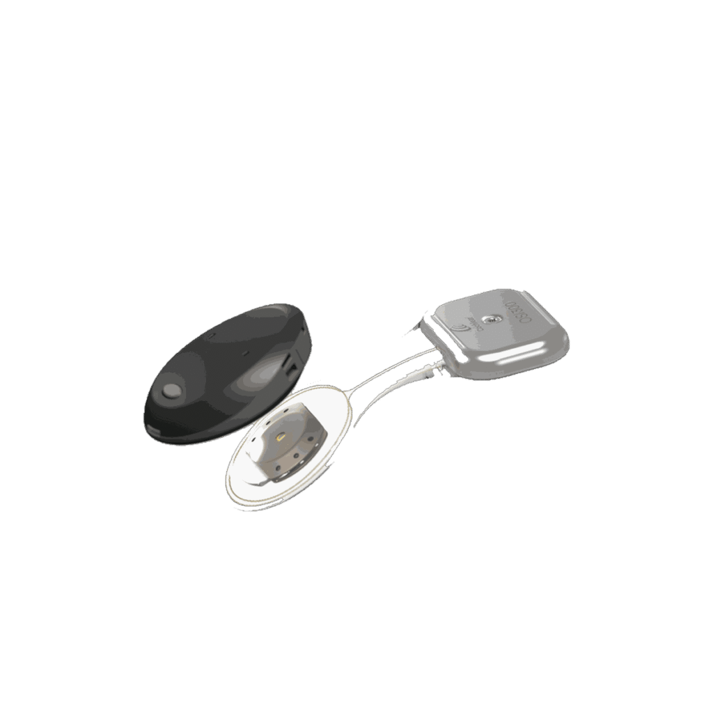 Cochlear™ Osia® OSI300 İmplant